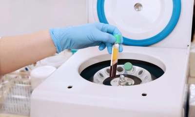 PRP blood cells being synthesised image